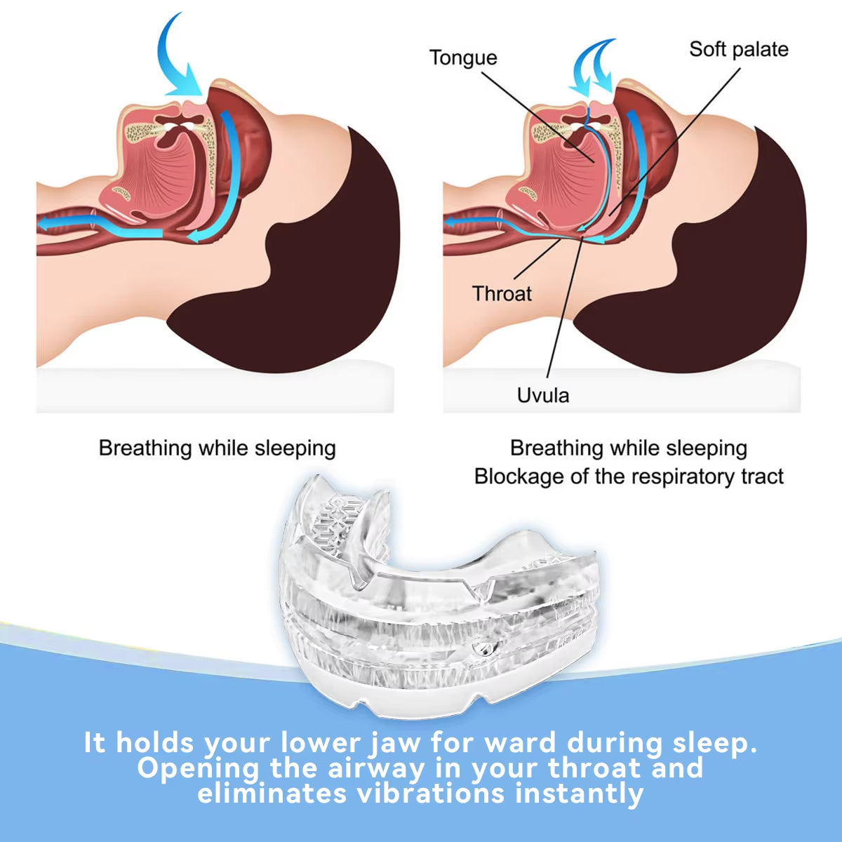 2024 New Arrival Adjustable anti Snoring Mouth Guard Braces Sleeping Anti-Snoring Devices Bruxism Improve Sleep Snore Mouthpiece