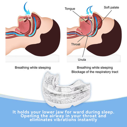 2024 New Arrival Adjustable anti Snoring Mouth Guard Braces Sleeping Anti-Snoring Devices Bruxism Improve Sleep Snore Mouthpiece